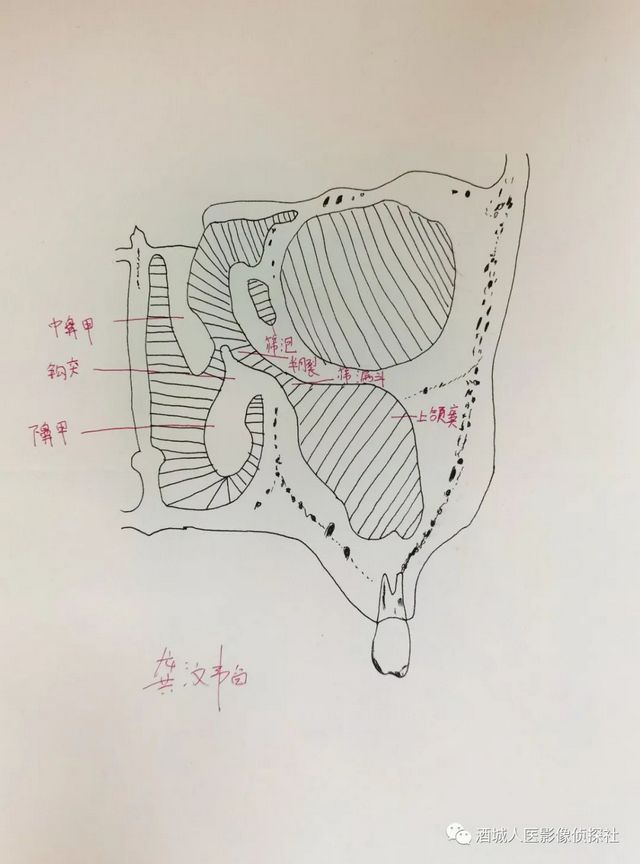生命之美——医学影像科实习学生寒假作业等你来投票!!(图5) 生命之美——医学影像科实习学生寒假作业等你来投票!!(图5)