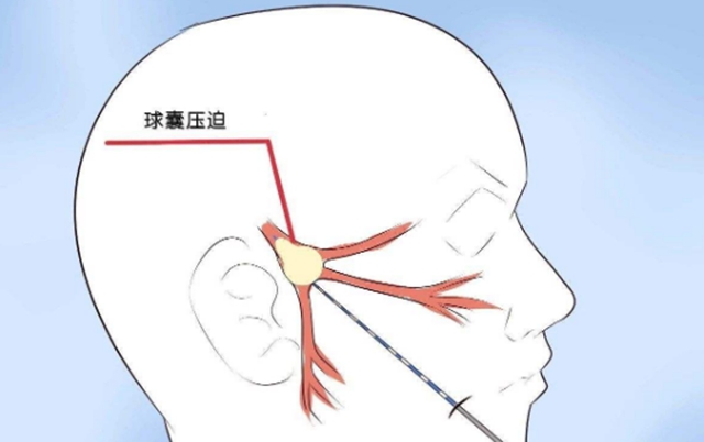 泸州一老人脸被“刀割”，痛不欲生！(图7)