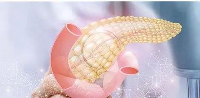 【警惕】轻微腹痛,竟被查出胰腺癌!(图6) 6.jpg