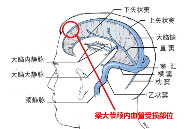 树3.png