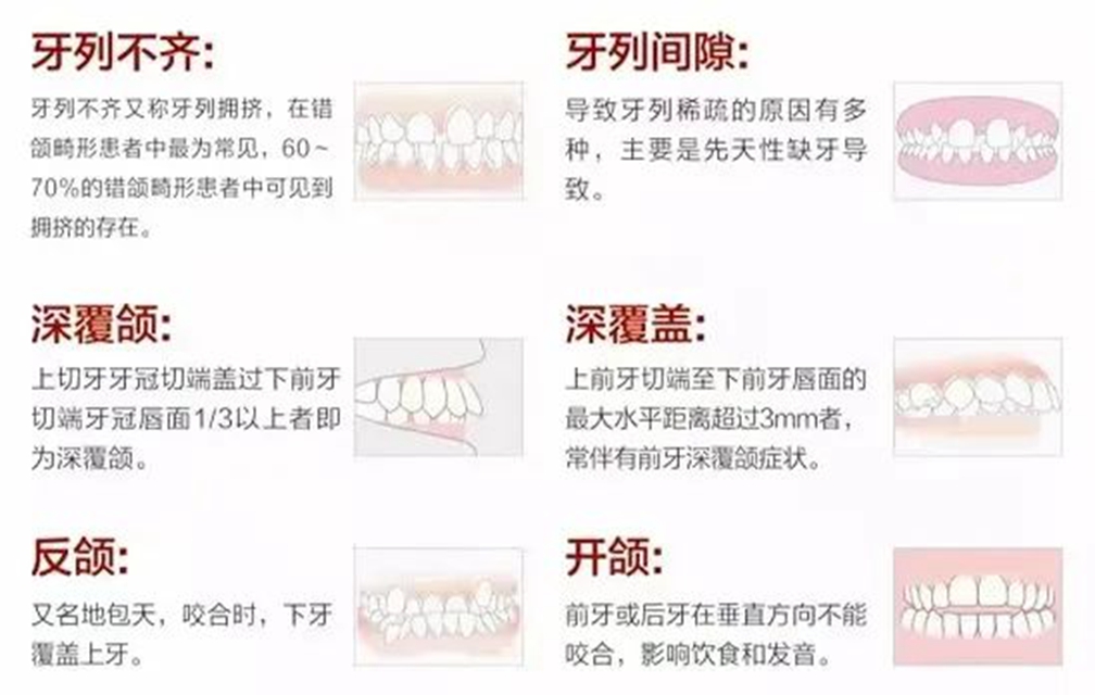 牙5.jpg