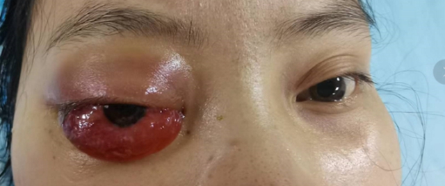八年前母亲因病去世，现在，女儿突发同样的疾病，结果……