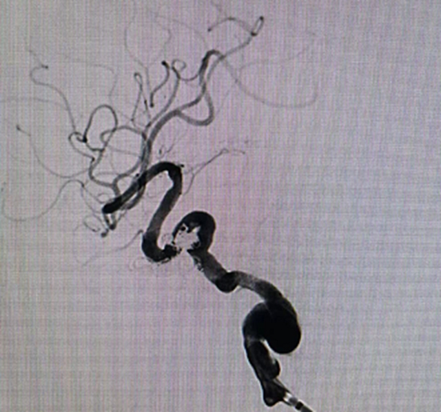 八年前母亲因病去世,现在,女儿突发同样的疾病,结果……(图4) 4.jpg