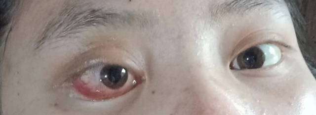 八年前母亲因病去世,现在,女儿突发同样的疾病,结果……(图6) 6.jpg
