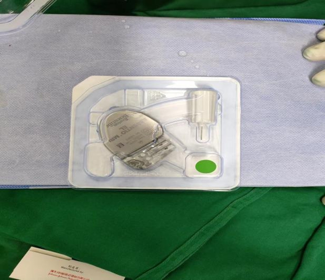 合江县中医医院:零突破!3例心脏人工永久双腔起搏器植入术成功开展(图4) 4.jpg