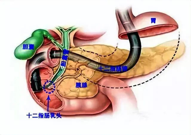 【围观】“疯狂的石头”,切了又长……(图3) 3.jpg