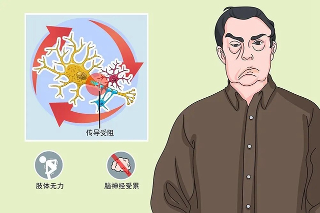 【罕见病】多为急性发病，面瘫也会致命！