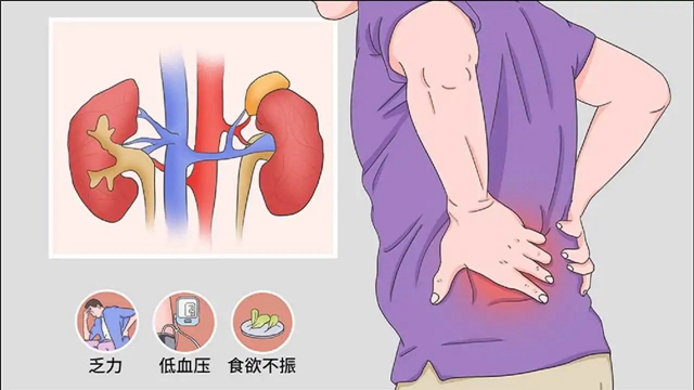 【警惕】恶心呕吐，男人的肾出问题了！