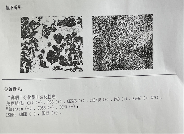 【围观】仅三个月，肿瘤就消失了，癌症有那么可怕吗？