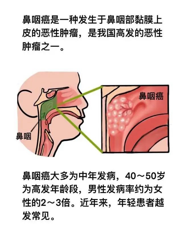 【围观】仅三个月,肿瘤就消失了,癌症有那么可怕吗?(图11) 微信图片_20231026093027.jpg