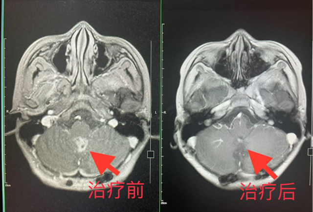 【扩散】2名泸州孃孃脑壳长“包”？