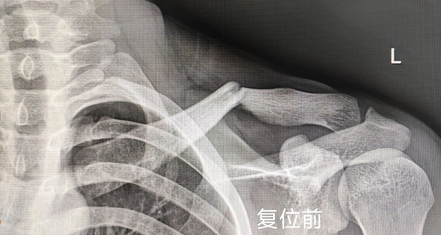 【围观】泸州又一“爬树哥”，这回遭了……