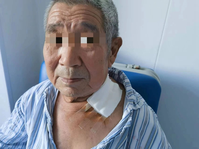 【围观】泸州男子脖子挨了一刀……