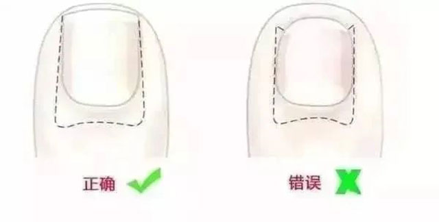 【提醒】春节孝敬长辈,这种方式得当心!(图5) 5.jpg