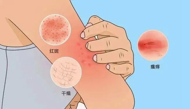 【科普】太折磨人啦!敏感肌肤换季期可这样护理→(图4) 微信图片_20240223092503.jpg