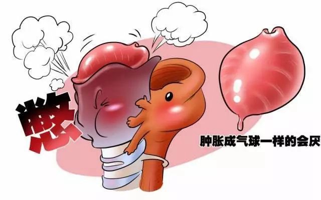 【扩散】这种喉咙痛,严重10分钟可致死!有这些症状,立即就医!(图5) 微信图片_20240227090305.jpg