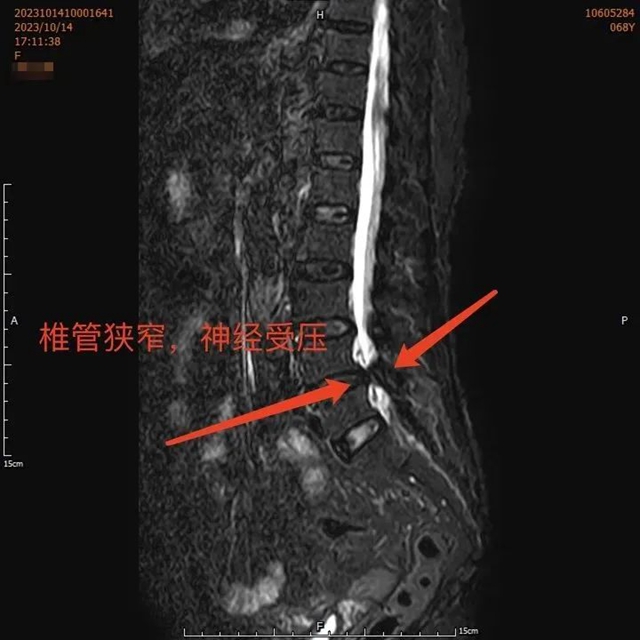 【扩散】一拖再拖,泸州嬢嬢的腰差点毁了……(图2) 微信图片_20240229092410.jpg