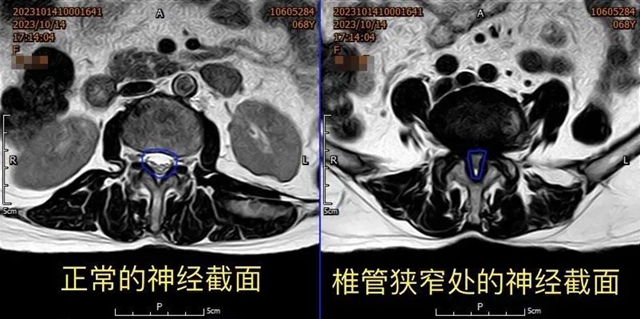【扩散】一拖再拖,泸州嬢嬢的腰差点毁了……(图3) 微信图片_20240229092415.jpg