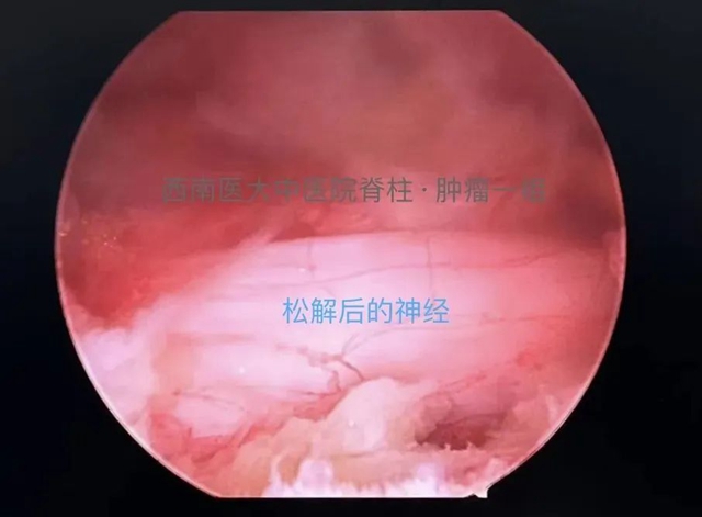 【扩散】一拖再拖,泸州嬢嬢的腰差点毁了……(图5) 微信图片_20240229092424.jpg