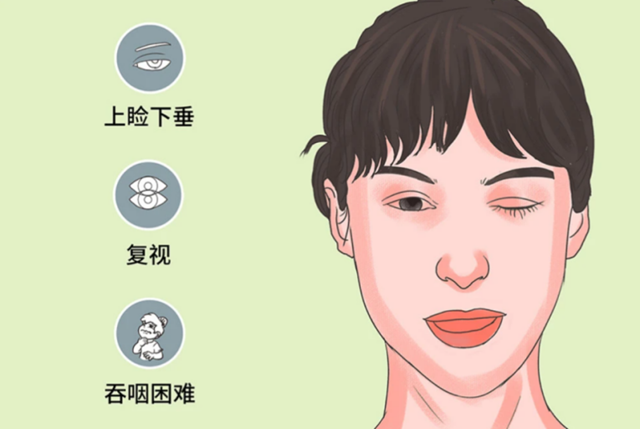 重症肌无力:你不孤单,我们与你并肩作战(图2) 微信图片_20240301091605.png
