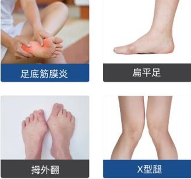 4D测体态!3D全足扫描!骨龄测试!泸州市人医义诊免费测!春季长高看这里!(图3) 义诊3.png