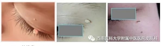 毒８.jpg