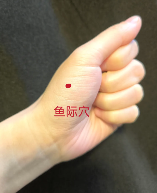 【扩散】一到夏天手上就长出的“小水泡”到底是什么?(图4) 微信图片_20240426094444.png
