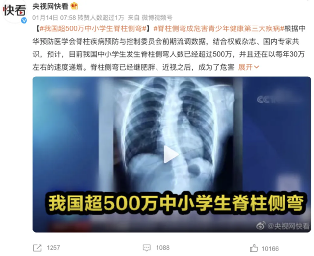孩子弯腰驼背O型腿？抓住关键时期，还能矫正！