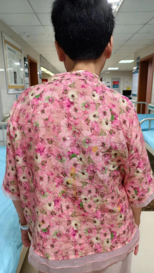 【围观】嬢嬢胸背痛2年，腰杆都痛弯了