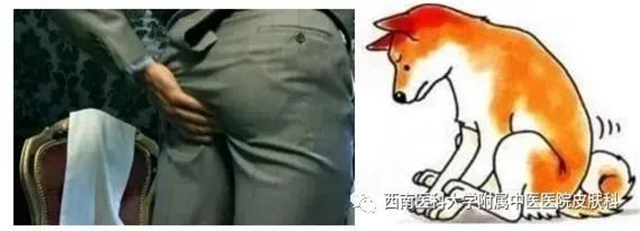 【警惕】大腿根痒得不得了，别挠了，要传染……