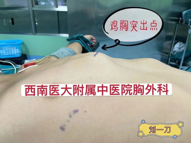 【惊险】钢丝断在小伙胸腔……