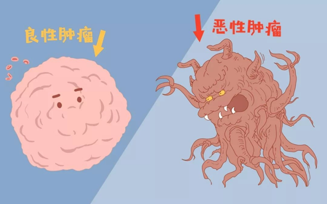 震惊！比“恋爱脑”更可怕的是“肿瘤脑”！