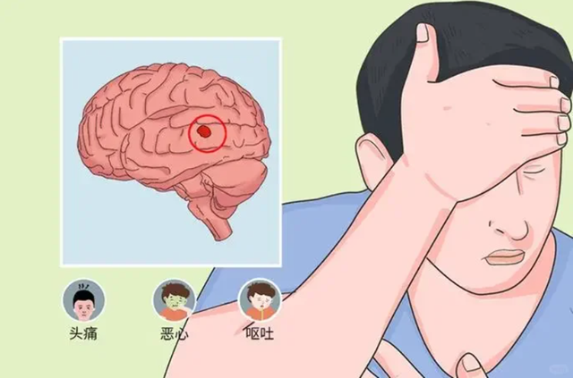 震惊!比“恋爱脑”更可怕的是“肿瘤脑”!(图2) 微信图片_20240912090606.png
