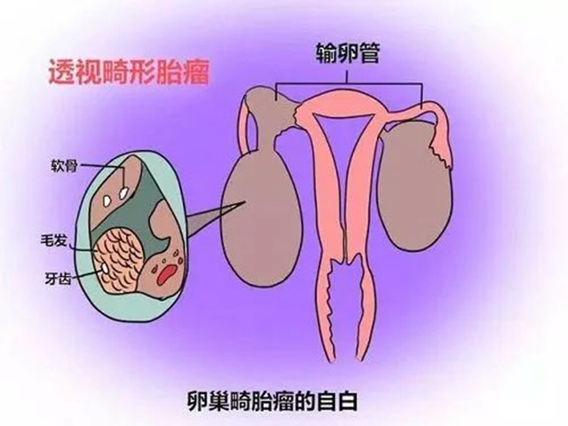 【围观】16岁花季少女“怀了个怪胎”，重达8斤......