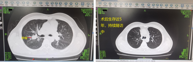 “文武”兼备，“肺”比寻常！