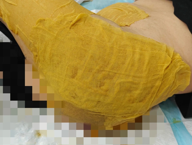 【围观】毒蛇钻进女子被窝，先咬PP后锁喉...…