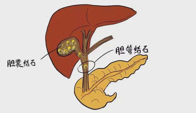 西南医大附院胆胰门诊开诊啦!(图7) 7.png