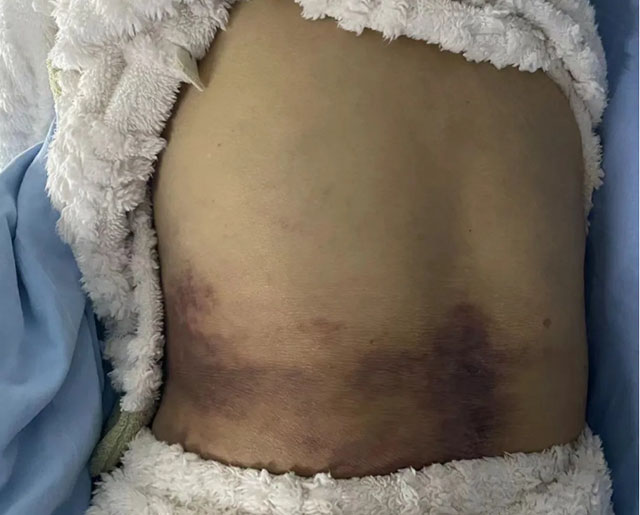【锦旗故事】患者寒冬赠锦旗,医患情意暖人心!(图4) 4.jpg