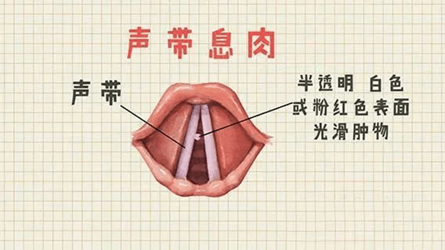 【警惕】话多、声音大、爱飙高音,可能真是病(图2) 病2.png