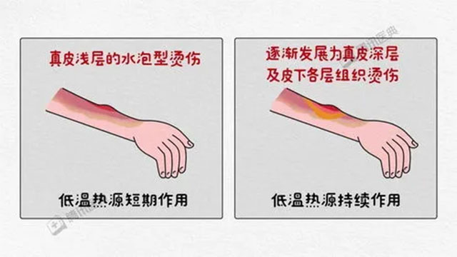 【好痛】一觉醒来,女子肚皮撕掉一块!(图5) 5.jpg