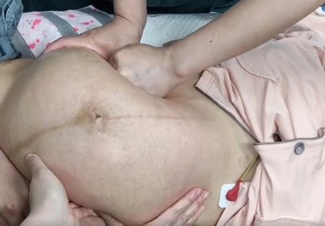 【厉害】又一例！2秒钟，医生徒手扭转胎位不正