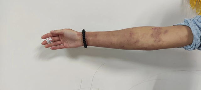 【酷】打飞的，女子多次从香港来找杨文信看病