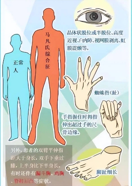 【医患故事】险象环生，男子5进鬼门关，多科协作成功救治