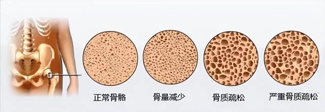 【警惕】一半的国人都不足,看看有没有你?(图5) 5.jpg