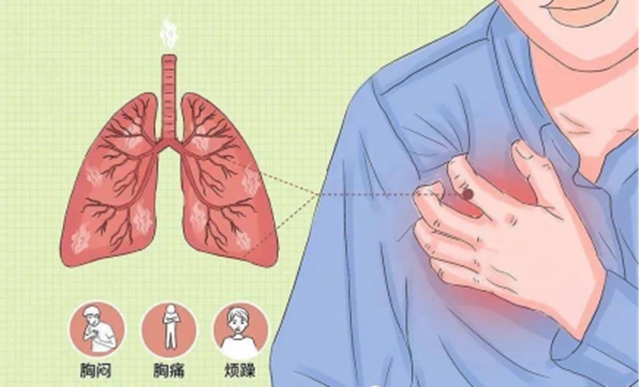 著名歌手因气胸去世！医生提醒：这些人群要注意→