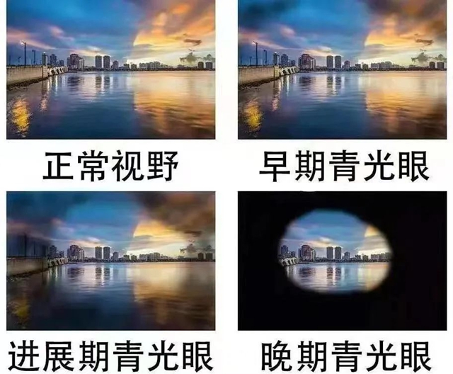 【警惕】关灯耍手机，可能会瞎……