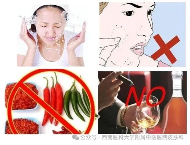 【关注】19岁小伙脸上疯狂“爆痘”,满脸“疙瘩”!(图8) 8.jpg