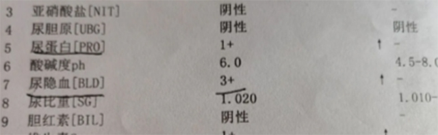 【警惕】女子一家三代都有血尿,外婆、妈妈、舅舅都遭了,有这些症状要当心(图1) 1.jpg