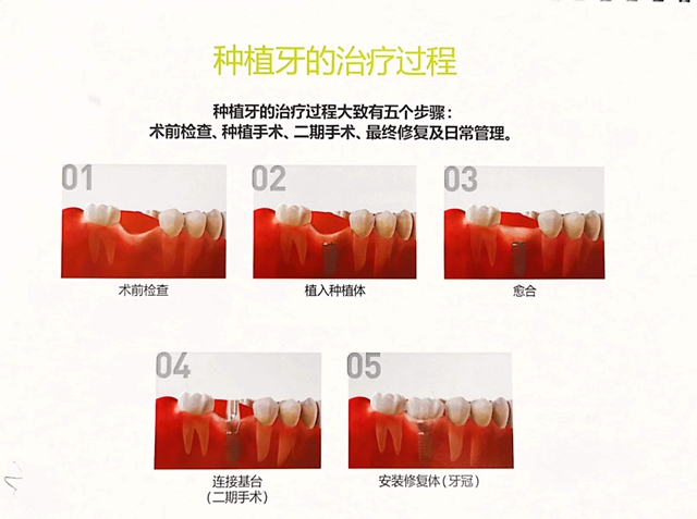 【关注】缺了一颗牙,男子一年多来无法正常进食……(图6) 6.jpg