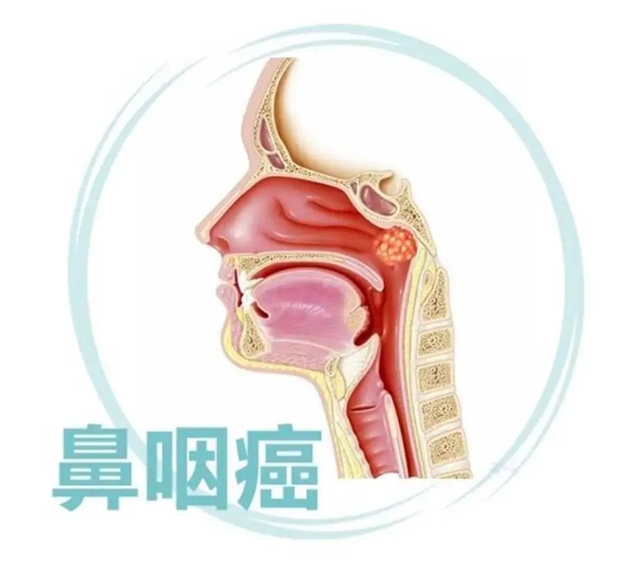 工2.jpg
